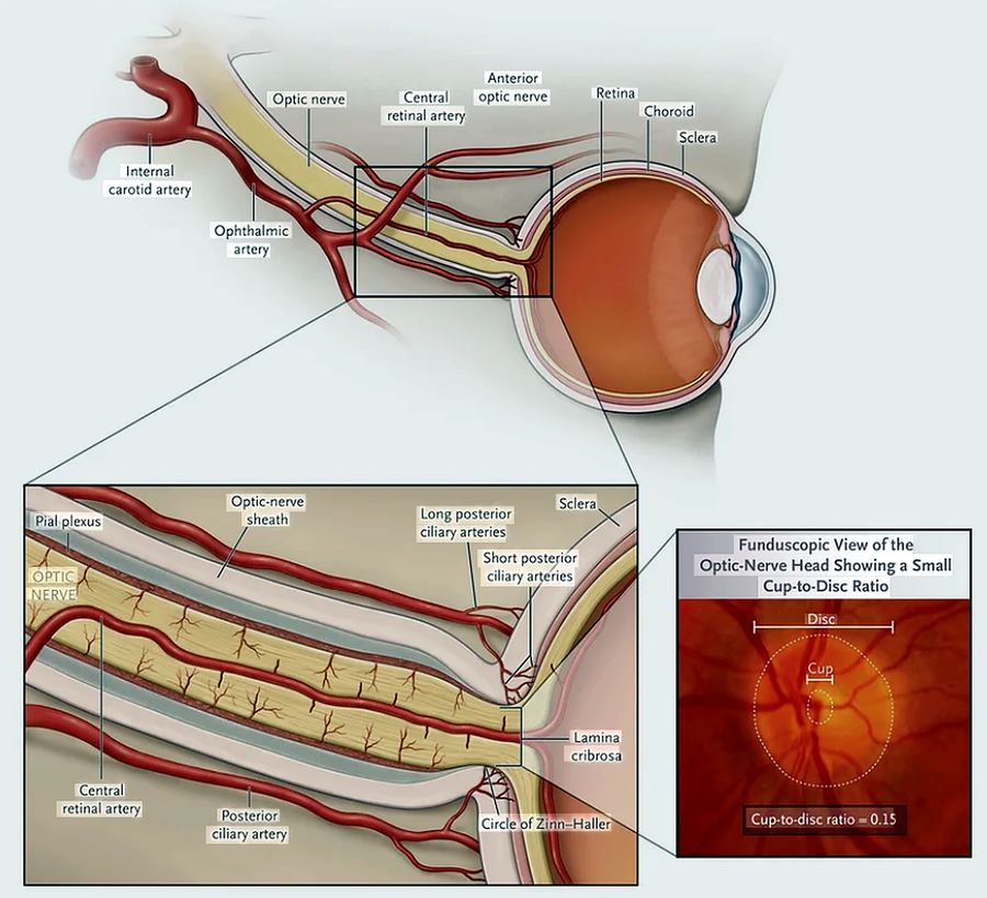Optic nerve blood flow anatomy in glaucoma