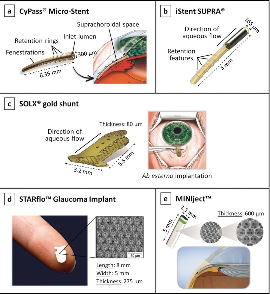 Comparison of MIGS devices in the 2026 glaucoma surgical pipeline