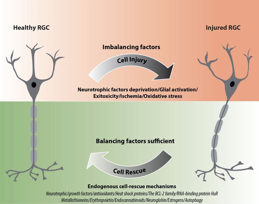 Healthy versus injured retinal ganglion cells in glaucoma