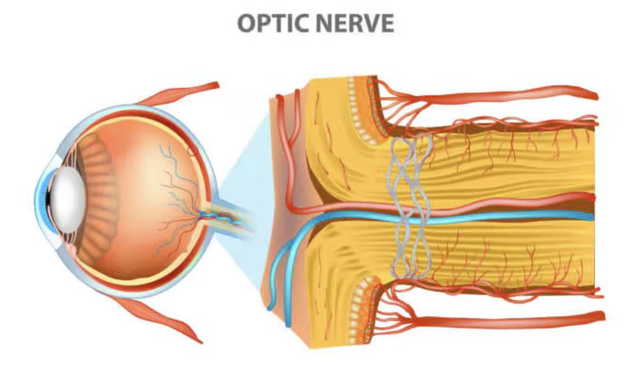 Cross-section of the optic nerve