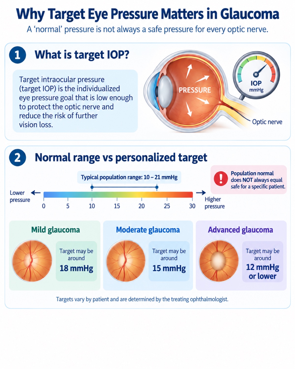 Chart showing why target eye pressure matters in glaucoma: the typical population range of 10 to 21 mmHg compared with individualized targets of about 18 mmHg for mild glaucoma, 15 mmHg for moderate glaucoma, and 12 mmHg or lower for advanced glaucoma